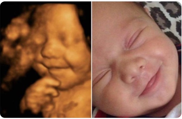 Snopes is forced to concede that yes, in-utero babies do smile