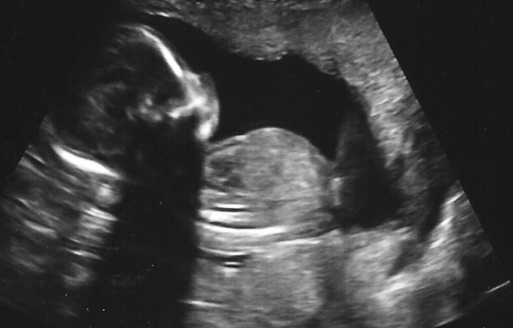 Kamala Harris’s ‘non-negotiable’ abortion position