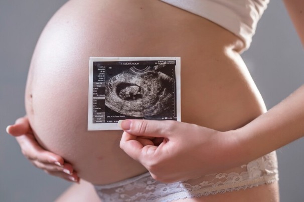 Republican state legislators’ premature pro-life legislation will re-elect Biden