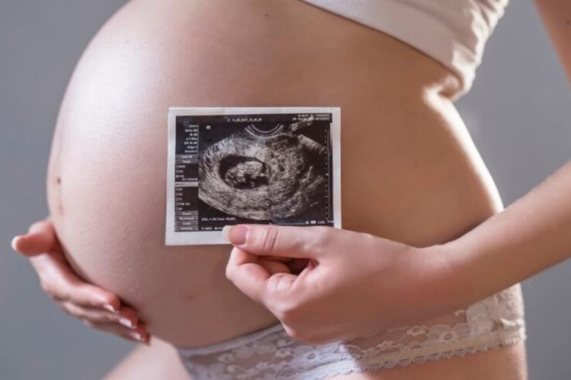 NextImg:Republican state legislators’ premature pro-life legislation will re-elect Biden