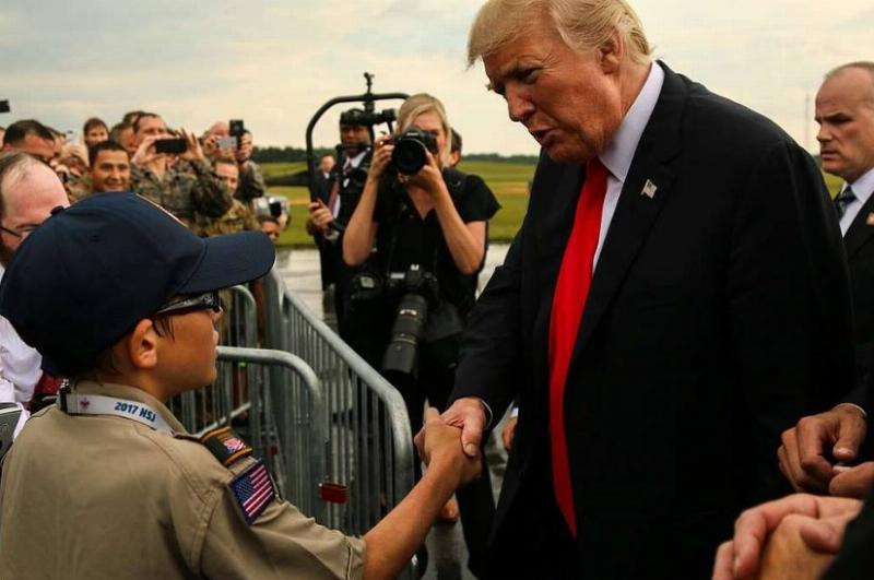 NextImg:Trump's bruised hands